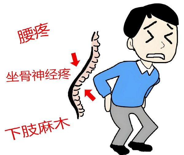 炒股资金配资 腰痛不是“老毛病”！你的腰椎正在提醒